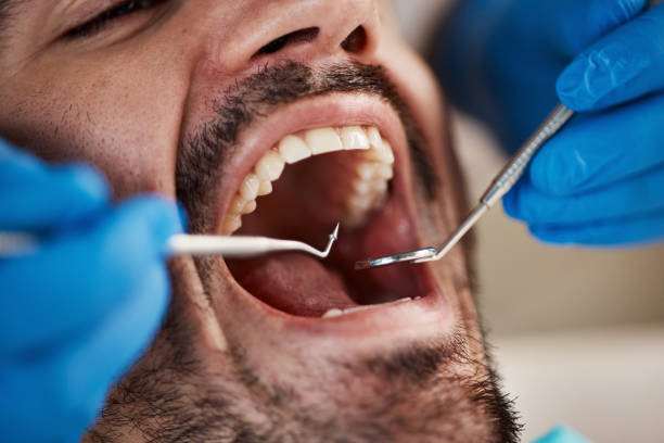 Best Broken Tooth Emergency  in Mojave, CA
